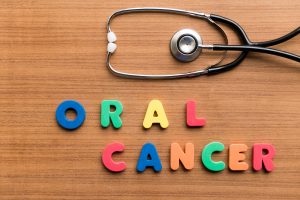 Addressing the Stages of Oral Cancer | Cerritos, CA