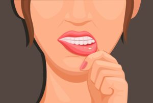 Closeup Cartoon Woman with White Mouth Sore