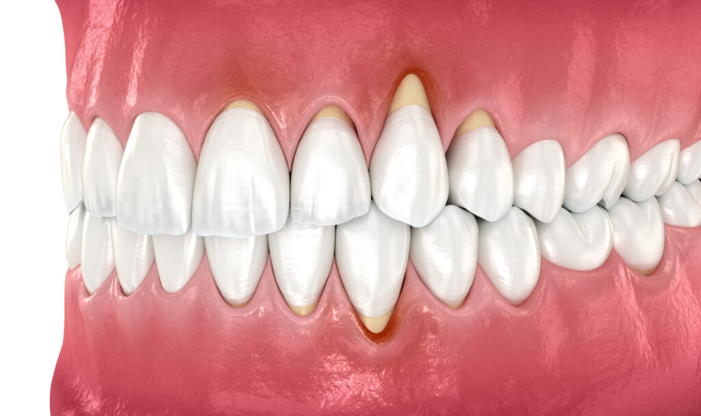 cerritos oral surgery