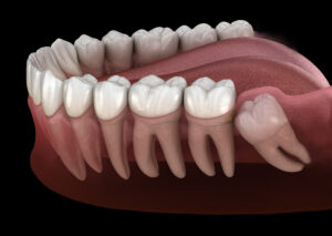 cerritos oral surgery