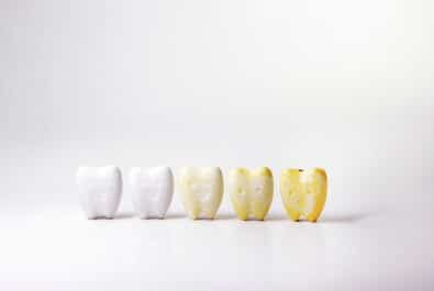 cerritos teeth whitening