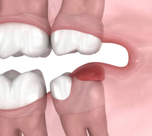 cerritos oral surgery